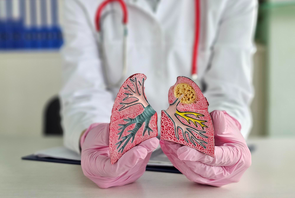 Tuberculosis (TB) Treatment